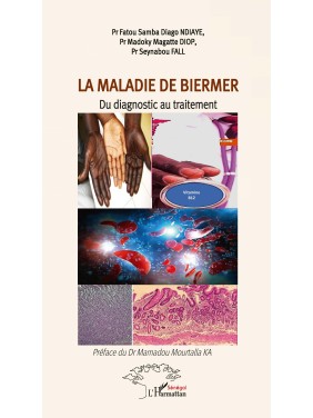 LA MALADIE DE BIERMER : DU...